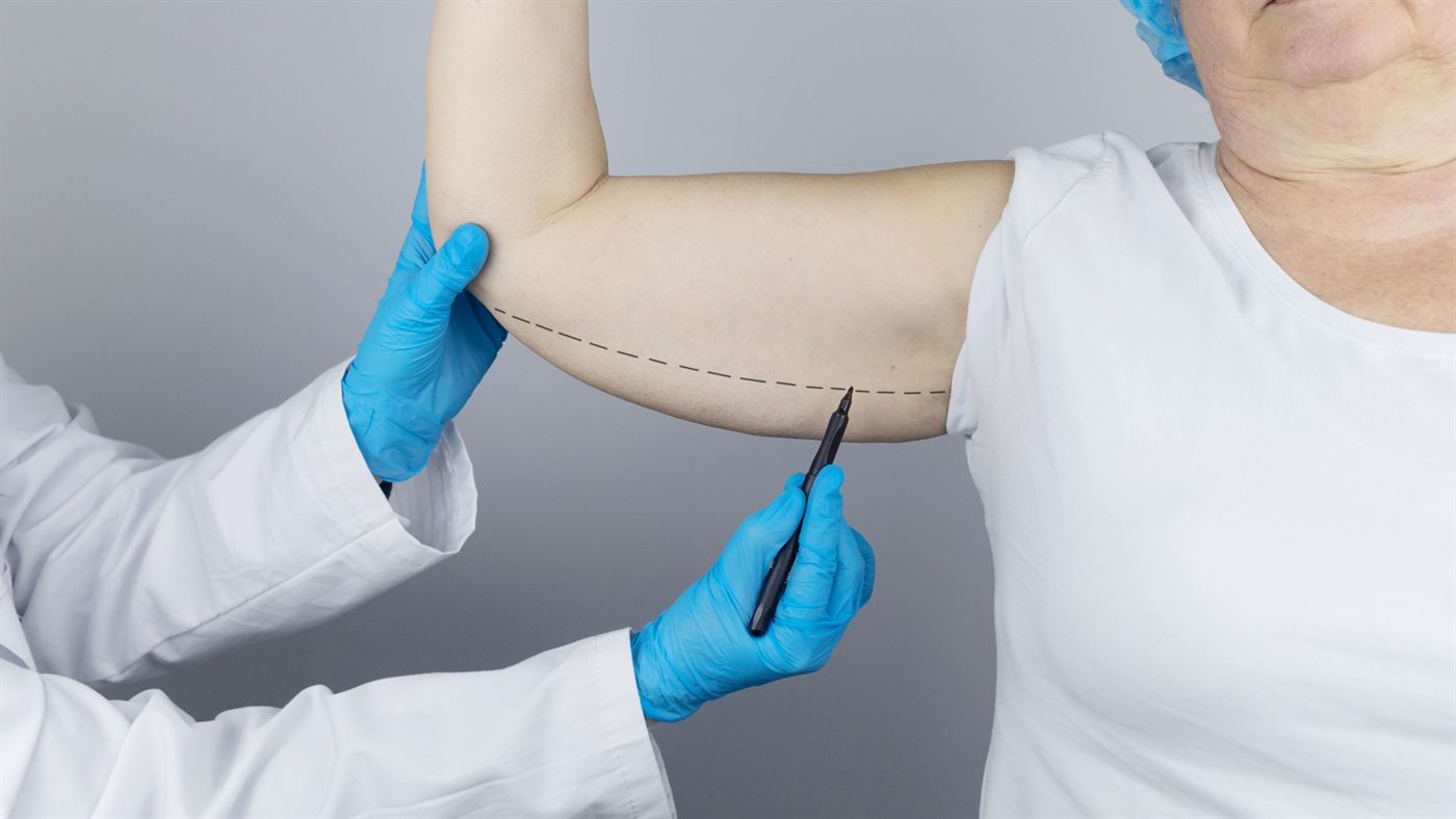 Braquioplastia — imagem ilustrativa
